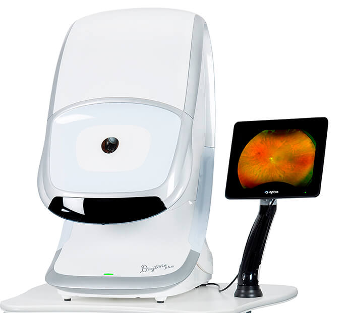 Optos ultra-widefield retinal imaging